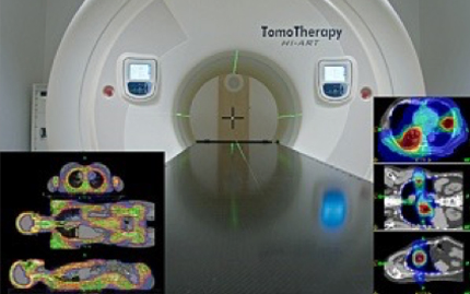 Cancers that can be cured via helical tomotherapy PHOTO01
